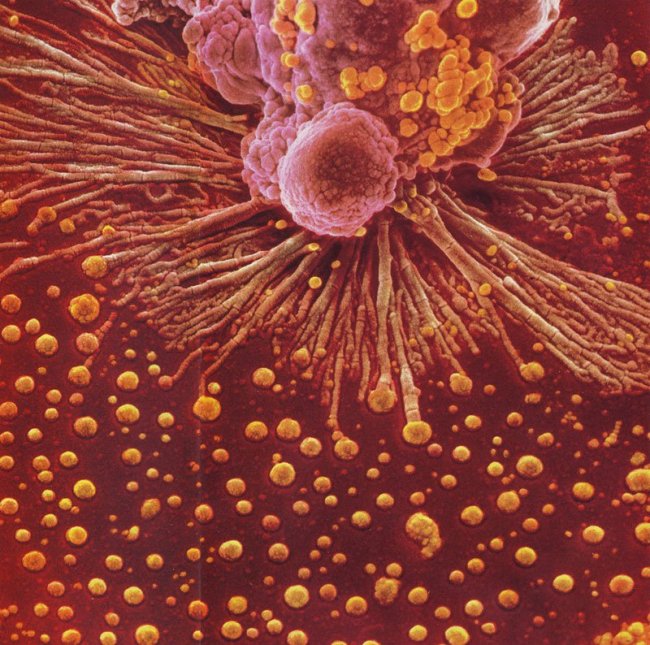 Наша невероятная иммунная система в микрофотографиях