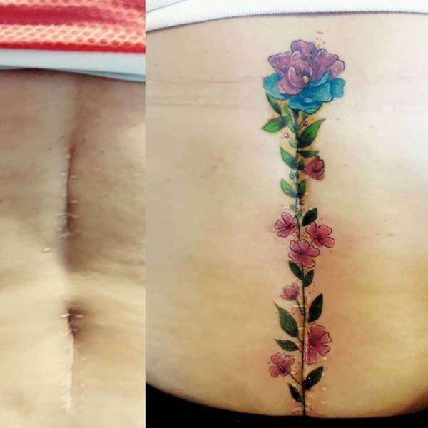 Татуировки, скрывающие изъяны на теле