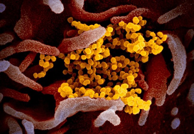 Как выглядит коронавирус под микроскопом