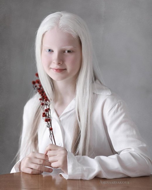 11-летняя девочка из Чечни с необычной внешностью